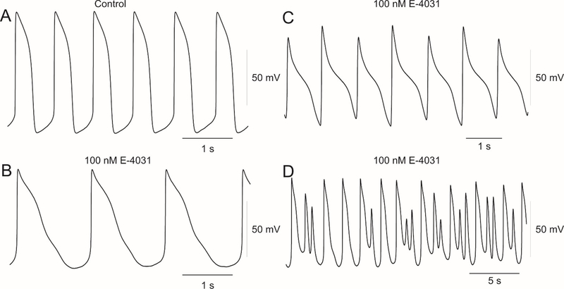 Role of the rapid delayed rectifier K<sup>+</sup> current in human induced pluripotent stem cells derived cardiomyocytes.