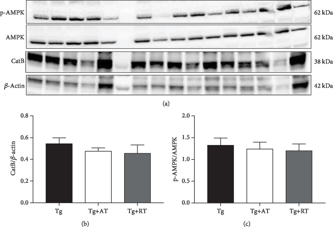 Hippocampal Growth Factor and Myokine Cathepsin B Expression following Aerobic and Resistance Training in 3xTg-AD Mice.