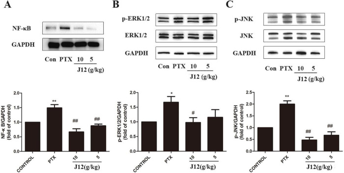 Siwei Jianbu decoction improves painful paclitaxel-induced peripheral neuropathy in mouse model by modulating the NF-κB and MAPK signaling pathways.