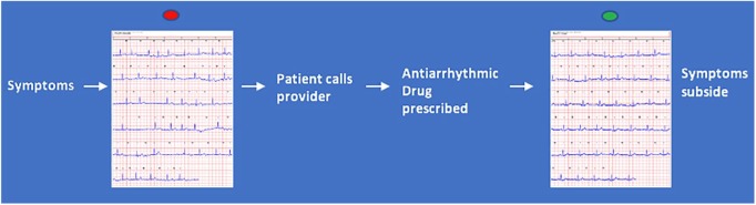 Smartphone ECG Monitoring System Helps Lower Emergency Room and Clinic Visits in Post-Atrial Fibrillation Ablation Patients.