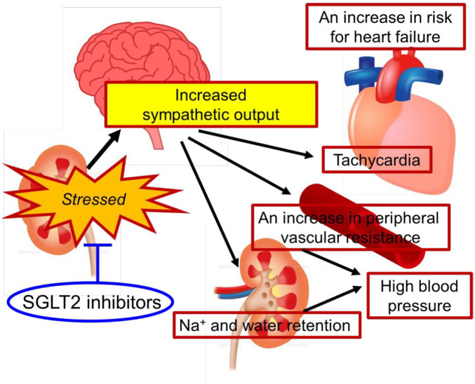 Sodium glucose cotransporter (SGLT)-2 inhibitors alleviate the renal stress responsible for sympathetic activation.