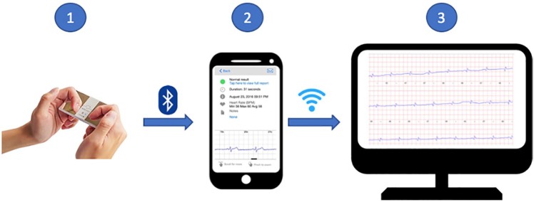 Smartphone ECG Monitoring System Helps Lower Emergency Room and Clinic Visits in Post-Atrial Fibrillation Ablation Patients.