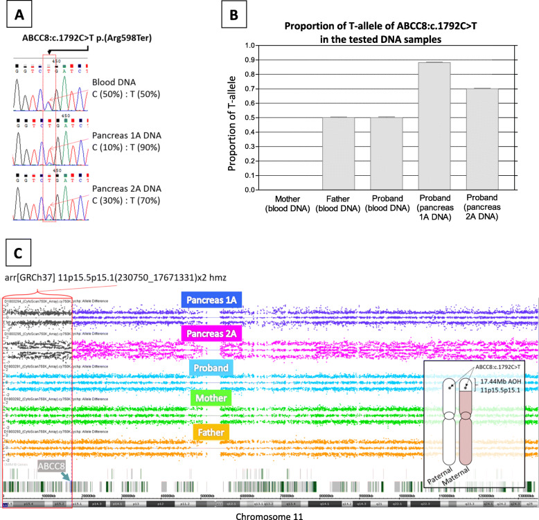 Coexistence of paternally-inherited <i>ABCC8</i> mutation and mosaic paternal uniparental disomy 11p hyperinsulinism.