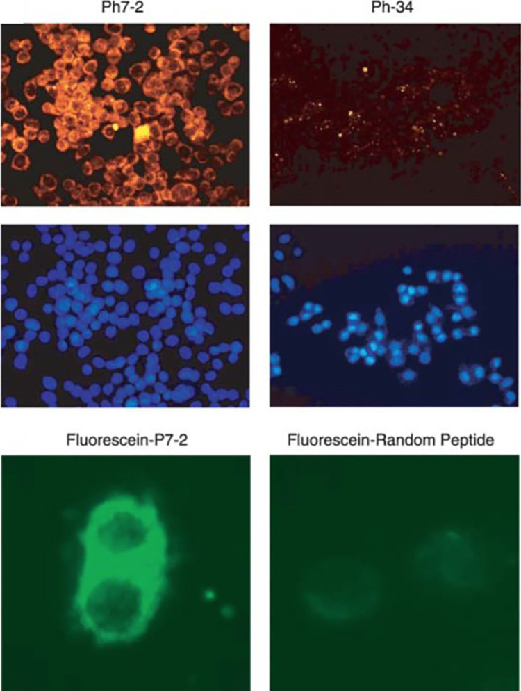 Peptide Based Imaging Agents for HER2 Imaging in Oncology.