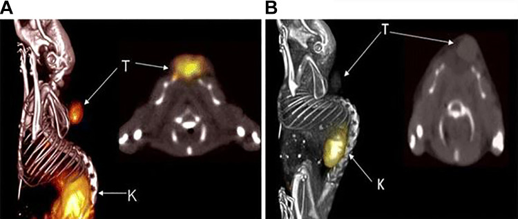 Peptide Based Imaging Agents for HER2 Imaging in Oncology.