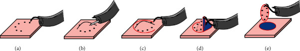 Surgical Robot for Intraluminal Access: An <i>Ex Vivo</i> Feasibility Study.