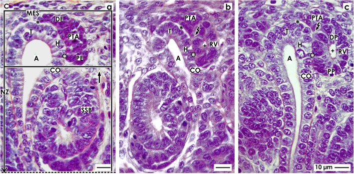 Shaping of the nephron - a complex, vulnerable, and poorly explored backdrop for noxae impairing nephrogenesis in the fetal human kidney.