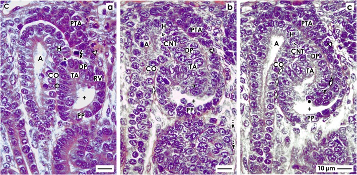 Shaping of the nephron - a complex, vulnerable, and poorly explored backdrop for noxae impairing nephrogenesis in the fetal human kidney.