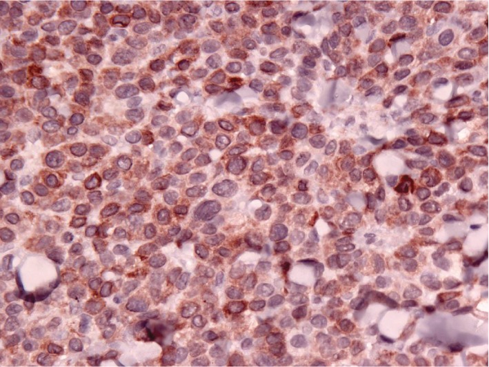 Subcutaneous B Cell Lymphoma in a Dog from the West Indies.