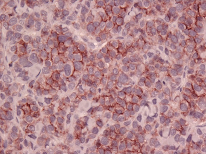 Subcutaneous B Cell Lymphoma in a Dog from the West Indies.