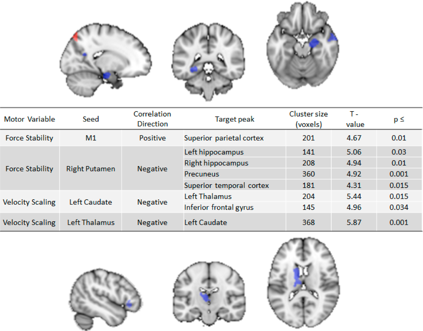 An Examination of Psychomotor Disturbance in Current and Remitted MDD: An RDoC Study.