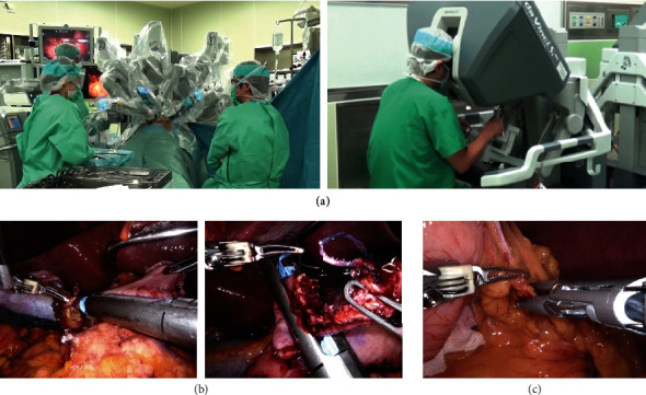 Robotic Surgery in Gastrointestinal Surgery.