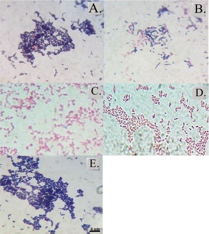 The hydrophobicity of enterobacteria and their co-aggregation with <i>Enterococcus faecalis</i> isolated from Serbian cheese.