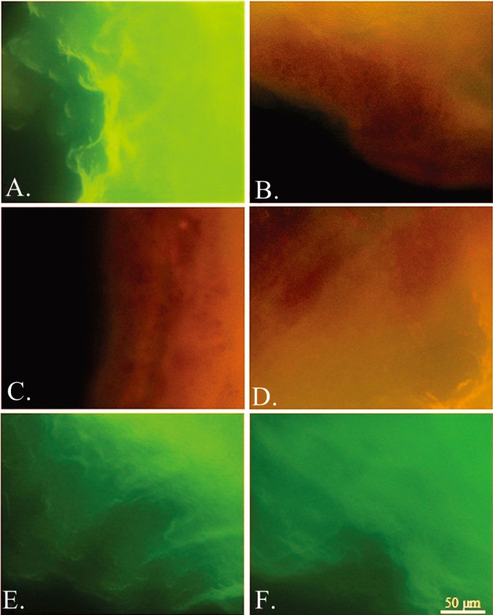 The hydrophobicity of enterobacteria and their co-aggregation with <i>Enterococcus faecalis</i> isolated from Serbian cheese.