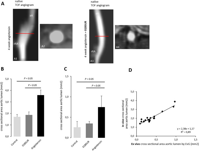 Molecular MR-Imaging for Noninvasive Quantification of the Anti-Inflammatory Effect of Targeting Interleukin-1β in a Mouse Model of Aortic Aneurysm.