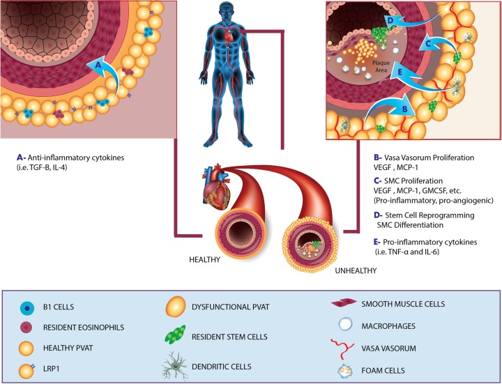 Potential role of perivascular adipose tissue in modulating atherosclerosis.