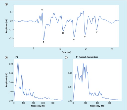 Baseline profiles of auditory, vestibular, and visual functions in youth tackle football players.