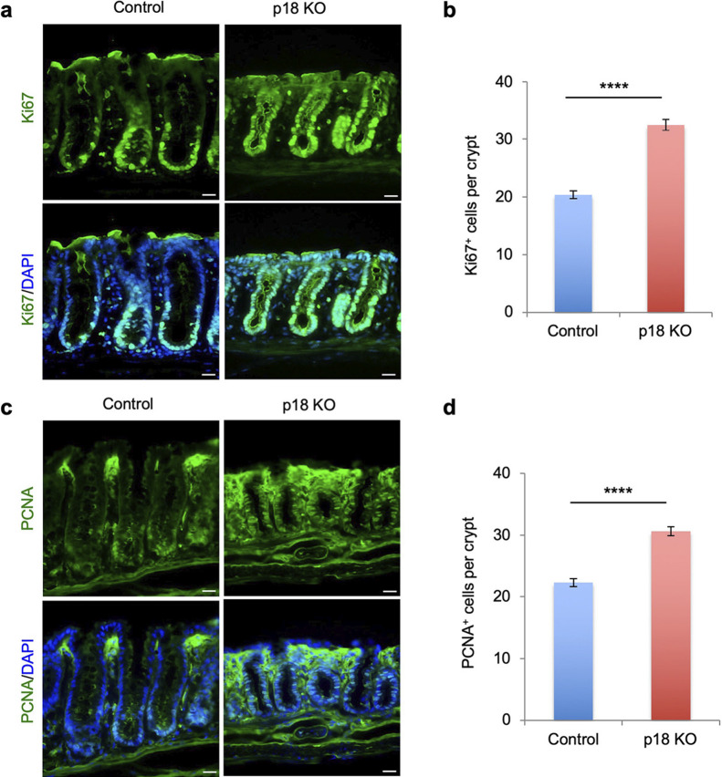 p18/Lamtor1-mTORC1 Signaling Controls Development of Mucin-producing Goblet Cells in the Intestine.