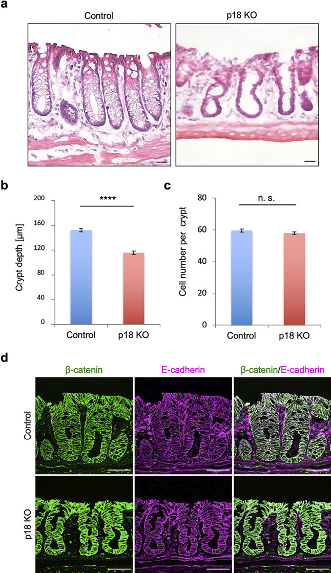 p18/Lamtor1-mTORC1 Signaling Controls Development of Mucin-producing Goblet Cells in the Intestine.