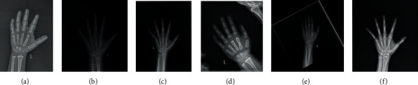 Ensemble Learning with Multiclassifiers on Pediatric Hand Radiograph Segmentation for Bone Age Assessment.