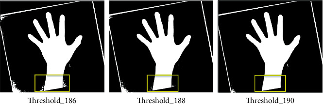 Ensemble Learning with Multiclassifiers on Pediatric Hand Radiograph Segmentation for Bone Age Assessment.