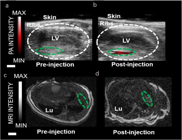 Recent advances in applications of multimodal ultrasound-guided photoacoustic imaging technology.