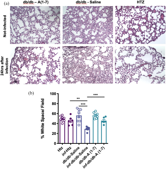 Countermeasure and therapeutic: A(1-7) to treat acute respiratory distress syndrome due to COVID-19 infection.