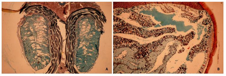 The coevolution between telson morphology and venom glands in scorpions (Arachnida).