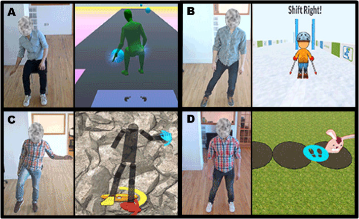 Acceptability and outcomes of an individualized exergaming telePT program for veterans with multiple sclerosis: a pilot study.