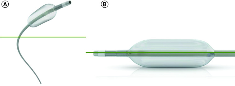 Balloon-occluded chemoembolization for hepatocellular carcinoma: a prospective study of safety, feasibility and outcomes.