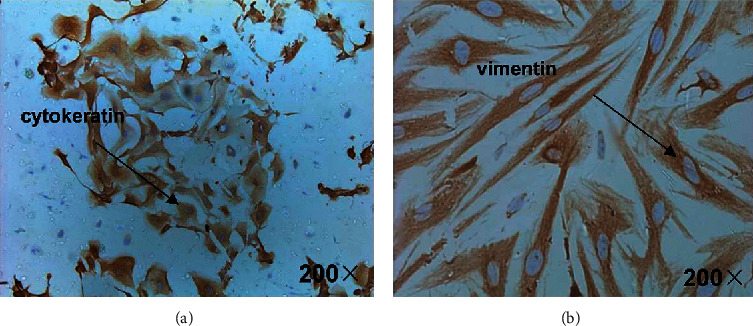 In Vitro Study on the Regulation of Annexin IV and VEGF by hCG in the Human Endometrium.