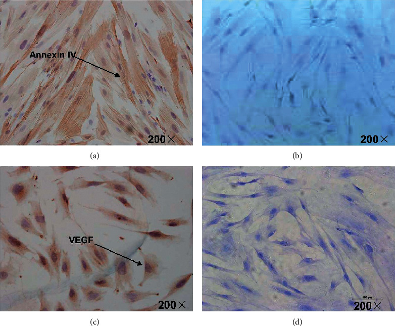 In Vitro Study on the Regulation of Annexin IV and VEGF by hCG in the Human Endometrium.