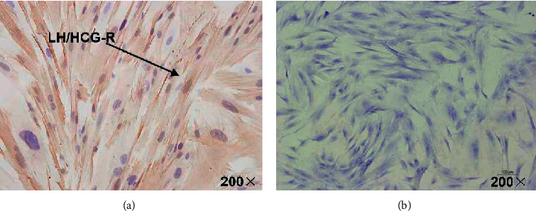 In Vitro Study on the Regulation of Annexin IV and VEGF by hCG in the Human Endometrium.