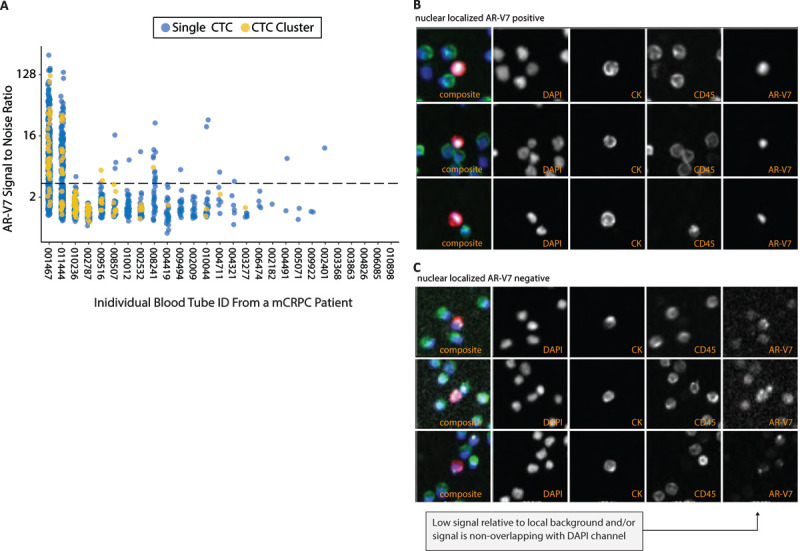 Development of an immunofluorescent AR-V7 circulating tumor cell assay - A blood-based test for men with metastatic prostate cancer.