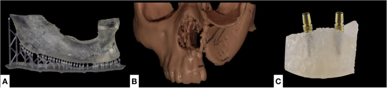 3D printed bone models in oral and cranio-maxillofacial surgery: a systematic review.