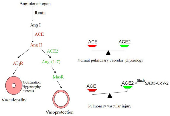 COVID-19 and the pulmonary vascular injury.