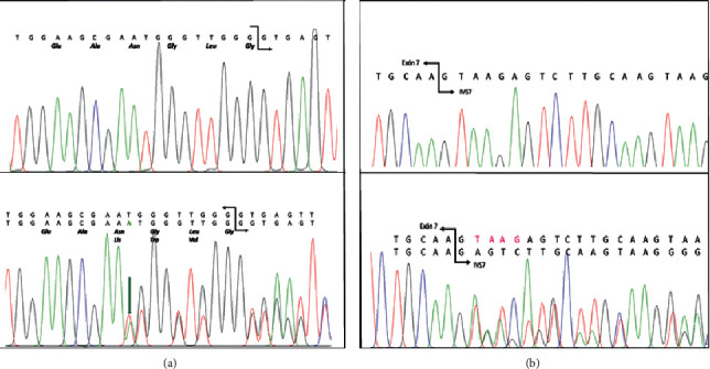 Acute Intermittent Porphyria in a Man with Dual Enzyme Deficiencies.