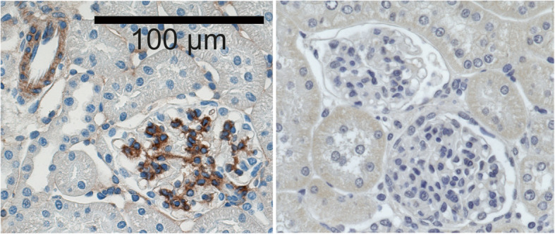 A role for the alpha-8 integrin chain (itga8) in glomerular homeostasis of the kidney.