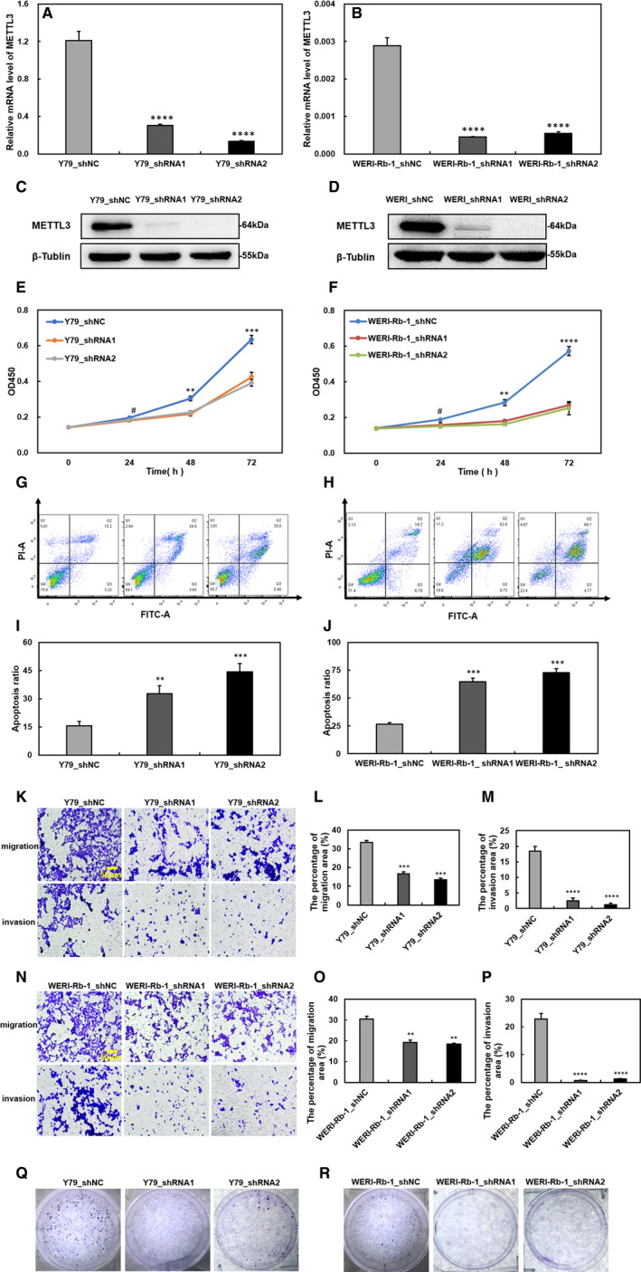 m<sup>6</sup> A methyltransferase METTL3 promotes retinoblastoma progression via PI3K/AKT/mTOR pathway.