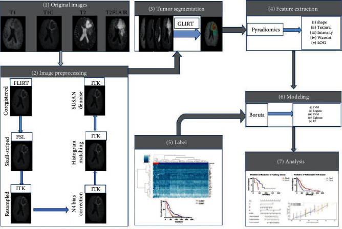 Machine Learning Based on a Multiparametric and Multiregional Radiomics Signature Predicts Radiotherapeutic Response in Patients with Glioblastoma.