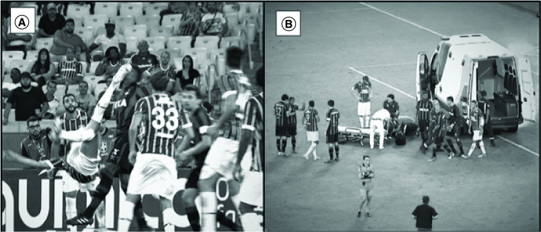 Concussion among soccer players in the 2017 Brazilian championship - the gap between protocol and medical practice.