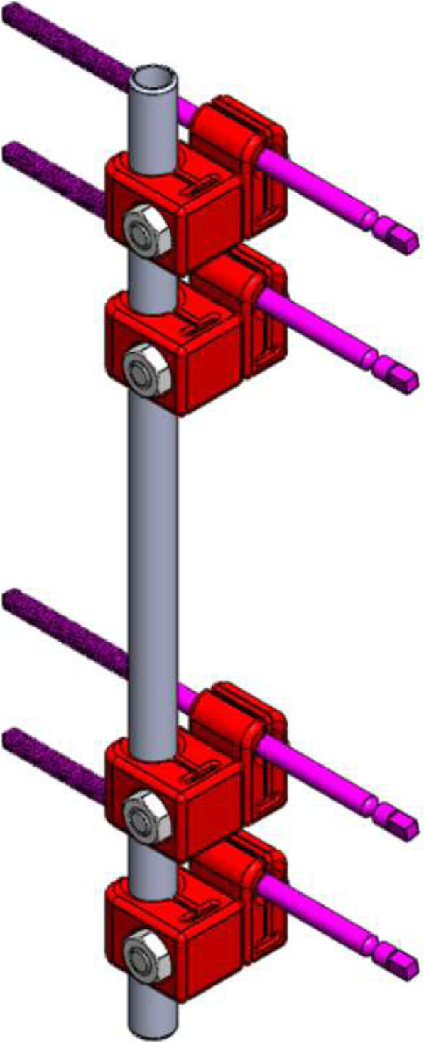 Low cost 3D printed clamps for external fixator for developing countries: a biomechanical study.