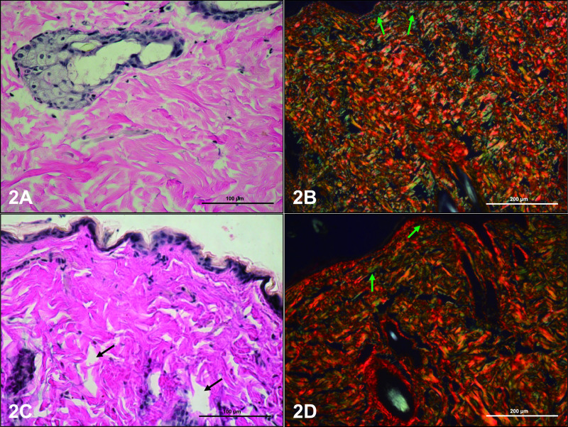 Morphological and Functional Changes in Skin of Adult Male Rats Chronically Treated with Letrozole, a Nonsteroidal Inhibitor of Cytochrome P450 Aromatase.