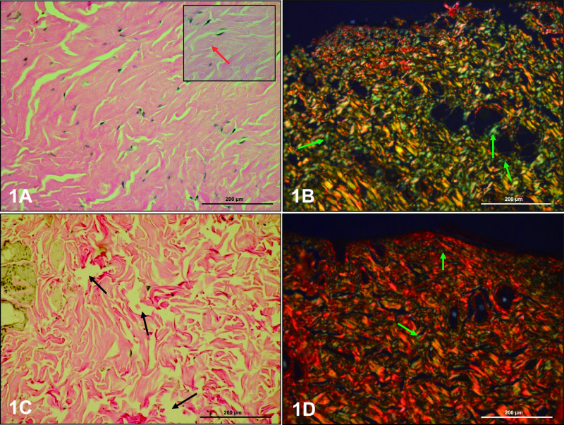 Morphological and Functional Changes in Skin of Adult Male Rats Chronically Treated with Letrozole, a Nonsteroidal Inhibitor of Cytochrome P450 Aromatase.