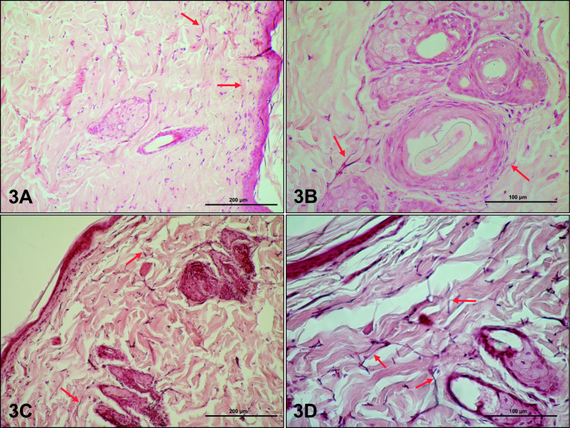 Morphological and Functional Changes in Skin of Adult Male Rats Chronically Treated with Letrozole, a Nonsteroidal Inhibitor of Cytochrome P450 Aromatase.