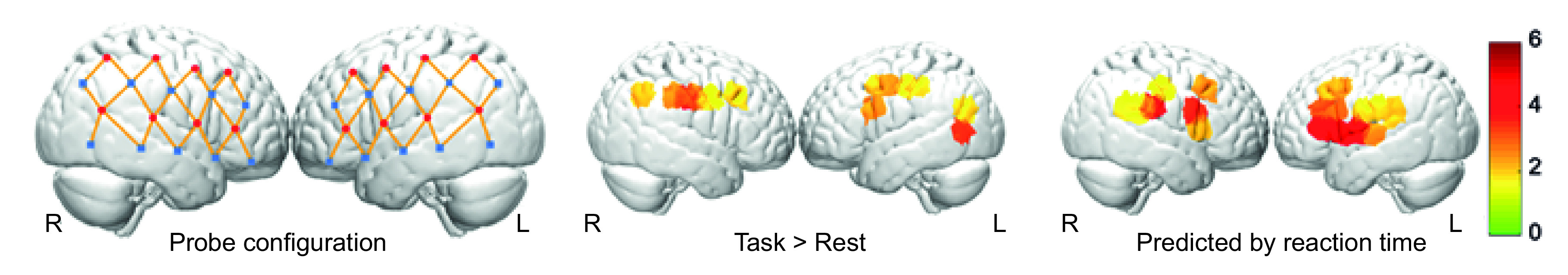 Persistent alterations of cortical hemodynamic response in asymptomatic concussed patients.