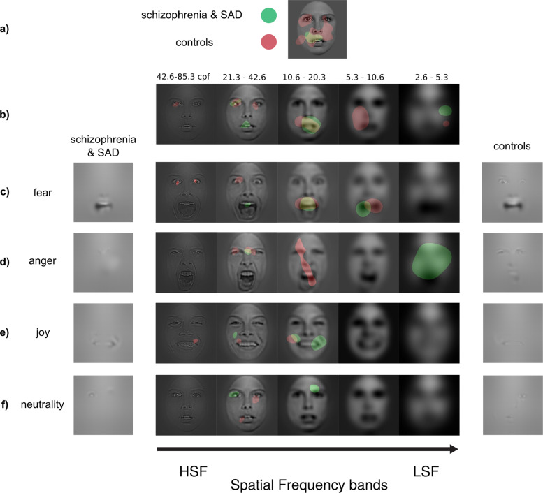 Abnormal visual representations associated with confusion of perceived facial expression in schizophrenia with social anxiety disorder.