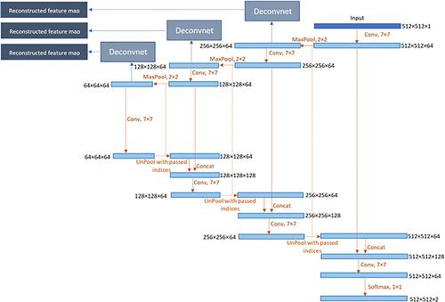 Visualizing and understanding inherent features in SD-OCT for the progression of age-related macular degeneration using deconvolutional neural networks