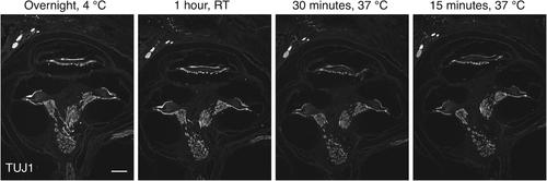 Tackling the Mouse-on-Mouse Problem in Cochlear Immunofluorescence: A Simple Double-Blocking Protocol for Immunofluorescent Labeling of Murine Cochlear Sections with Primary Mouse Antibodies