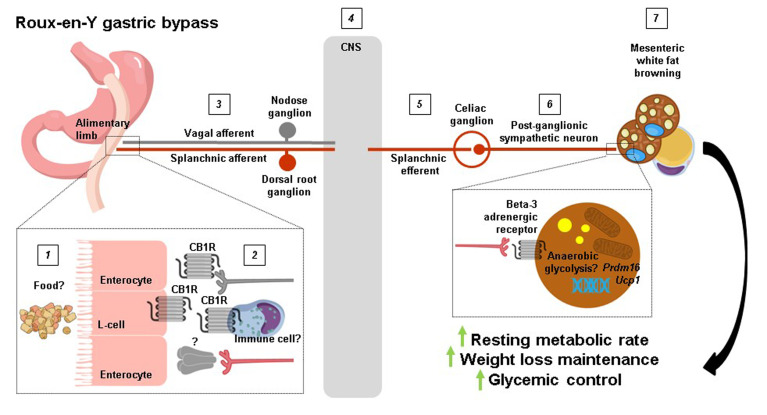 A sympathetic gut connection drives the metabolic benefits of Roux-en-Y gastric bypass.